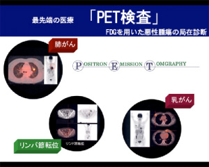 1. 「PET検査」のイメージ